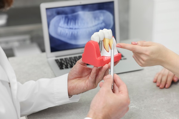 Periodontics And Dental Implants: How They Work Together